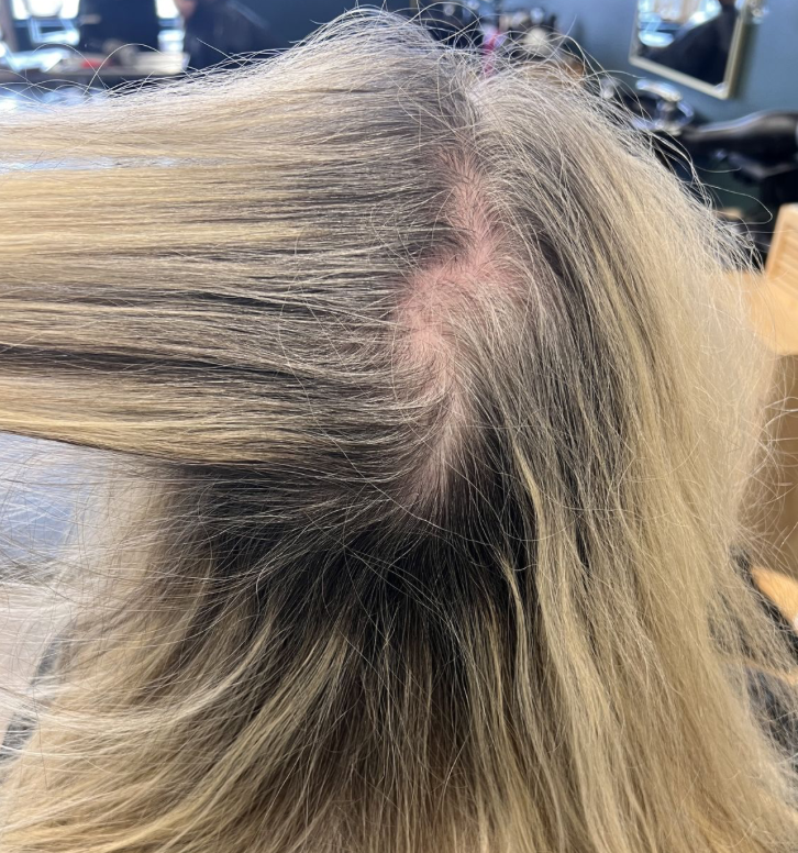 ALL_news_26C18_LAzvJiloHN ALL_news_26C18_LAzvJiloHN